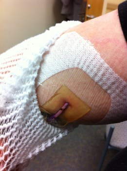PICC Line